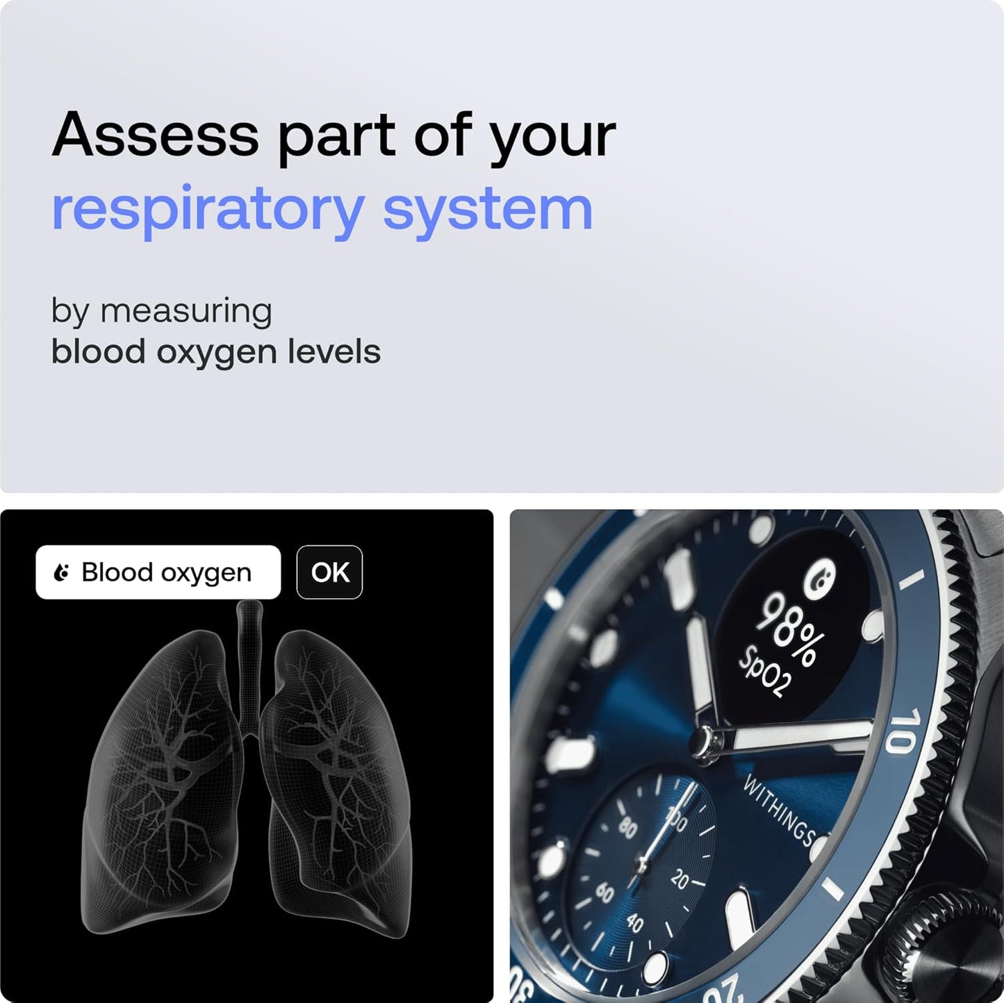 Scanwatch Nova - Heart Health Hybrid Smart Watch for Men & Women - SPO2, Temperature Monitoring, Sleep, Respiratory Health, Cycle Monitoring, 30-Day Battery Life, Apple Ios/Android